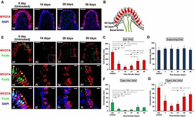 Alteration of Musashi1 Intra-cellular Distribution During Regeneration Following Gentamicin-Induced Hair Cell Loss in the Guinea Pig Crista Ampullaris